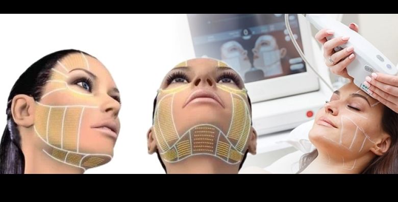 72posto SNIZENO HIFU tretman cijeloga lica vrata i podbratka  najtrazeniji tretman pomladjivanja sa vrhunskim rezultatima u CROOZON STUDIO Zagreb za samo 119 € 