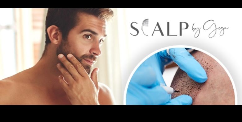 Uklonite oziljke uz Mikroscalp tretman u Studiju ljepote by Goga  tehnika koja precizno kamuflira oziljke na glavi ili bradi stvarajuci izgled prirodne kose ili dlacica 