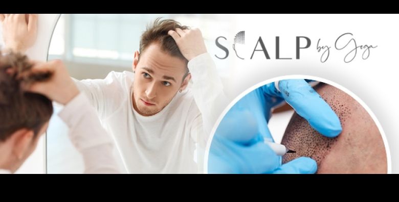 Rijesite problem prorijedjene kose i celavosti uz mikropigmentaciju vlasista Prirodno gusca kosa bez boli i operacije u Studio ljepote by Goga u Zagrebu po akcijskoj cijeni 