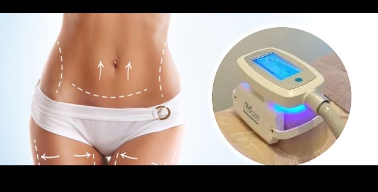 Zamrznite masne naslage i pohvalite se super rezultatima Natural Body and Soul u Rijeci donosi Vam kriolipoliza paket  2 sonde cryo shape na zeljene zone u jednom dolasku 