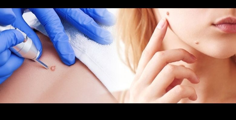 Garantirani polasci - Akcija, popust i sniženje. (ponuda: 254243)