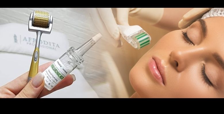 Ljubimci - Akcija, popust i sniženje. (ponuda: 255086)