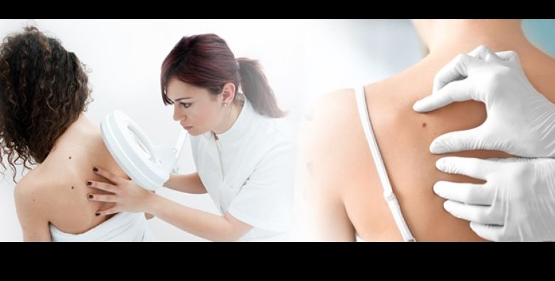 Rijesite se madeza bradavica ili lipoma brzo i sigurno uz dermatoskopski pregled i lokalnu anesteziju u Poliklinici Superiora u Zagrebu 