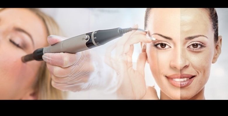 ISPEGLAJTE BORE uz prirodni botox  iglicna MEZOTERAPIJA botopeptidima u Medelina Health Studiu u Zagrebu uz dr Sanju Jelekovic 