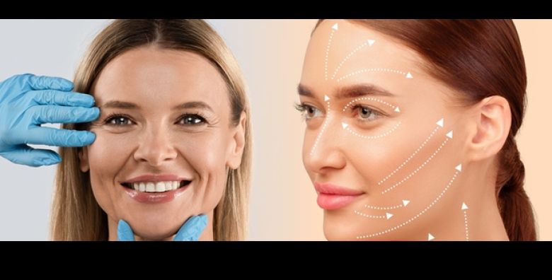 Poliklinika Superiora  kompletni FACE LIFT: lifting cela srednjeg dijela lica podbratka i gornje usne uz VRHUNSKE rezultate i prirodan pomladjen izgled 