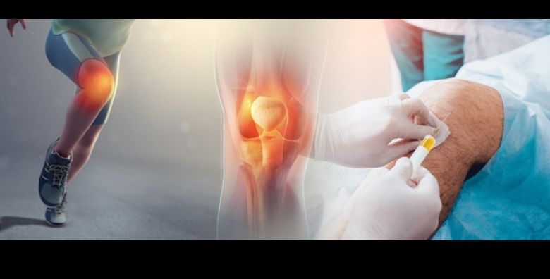 Dragocjeno OLAKSANJE za BOLNA KOLJENA uz Polikliniku VitalArt iz Zagreba i TERAPIJU HIJARULONSKOM KISELINOM Zaboravite na bol krecite se s LAKOCOM i sprijecite daljnja ostecenja 