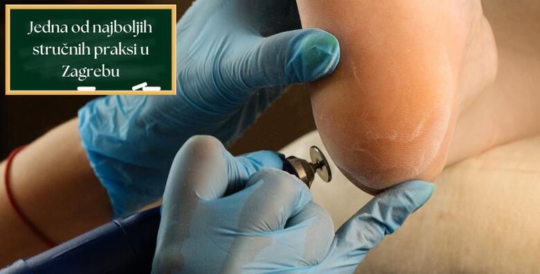 Tecaj medicinske pedikure  naucite pravilnu obradu nokta te otklanjanje boli i problema uz GRATIS medicinsku parcijalnu masazu za svakog upisanog polaznika u Ustanovi Dominus