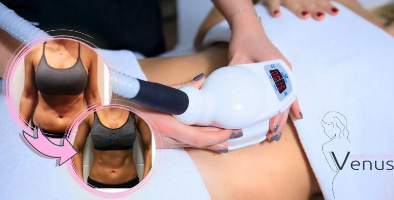 Smrsavite uz NAJBOLJE APARATE NA TRZISTU Istopite masnoce uz Med2Contour Teslu  RF limfnu drenazu i tretman po vasem izboru 