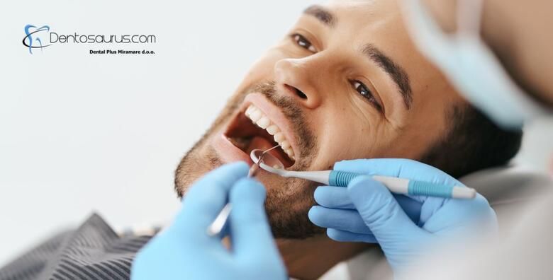 Jednoplosni kompozitni ispun  za osmijeh pun samopouzdanja uz pregled i savjetovanje u ordinaciji Dental Plus Miramare