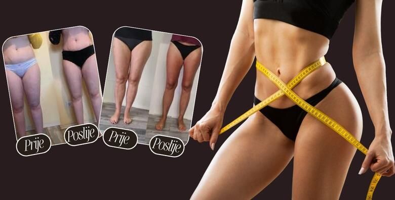 Oblikujte tijelo uz 5 tretmana aparativne limfne drenaze 5 tretmana Vacuslim 48 i 5 tretmana elektrostimulacije misica u Glam Lab u