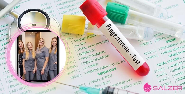 Analiza spolnih hormona za zene Zagreb i Velika Gorica  analiza hormona ESTRADIOL E2  FSH LH i PROGESTERON u Poliklinici Salzer
