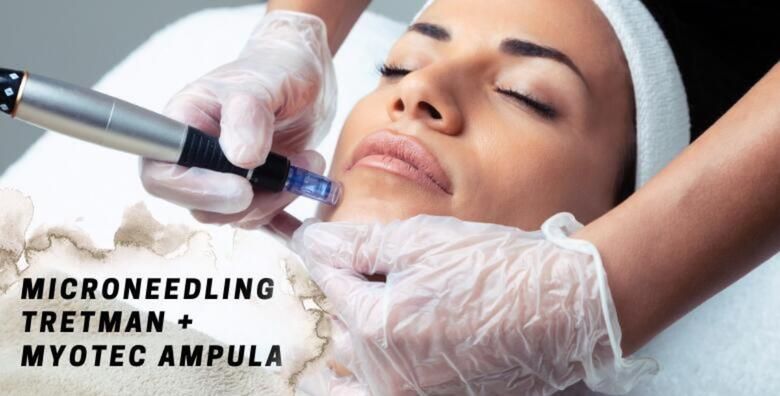 MICRONEEDLING DERMAPEN  vratite sjaj i pomladite svoju kozu uz poznatu nekirursku metodu u kombinaciji sa antiage serumom u Centru zdravlja i ljepote Dita