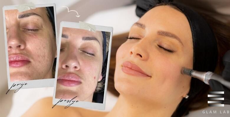 Edukacije (ponuda: 251503)