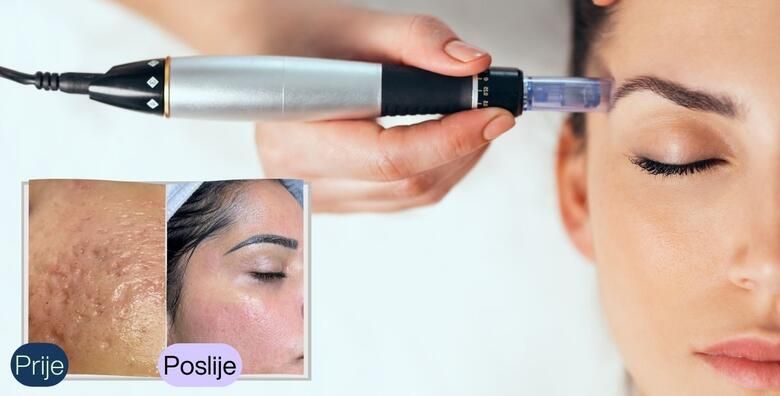 Ljepota (ponuda: 252234)