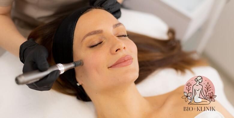 Vratite sjaj i elasticnost kozi lica uz tretman microneedlinga u Studiju Bio klinik