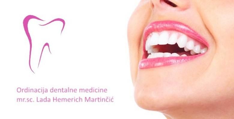 Pregled s konzultacijama ciscenje zubnog kamenca i pjeskarenje te poliranje i premaz Tooth Mouse pastom u Ordinaciji dentalne medicine Lada Hemerich Martincic