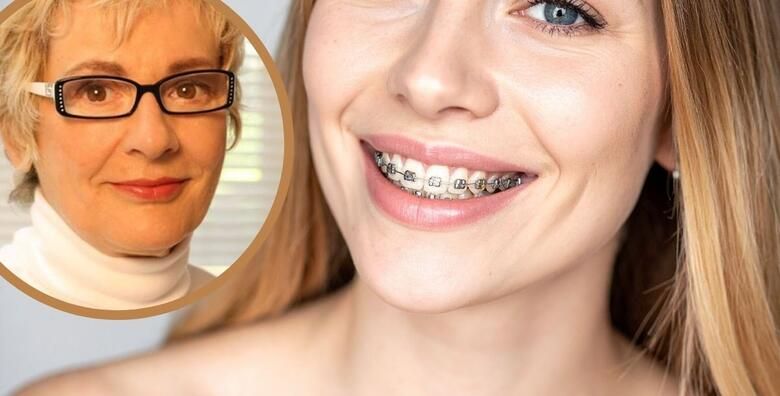 FIKSNI APARATIC ZA ZUBE  konvencionalni metalni uz ukljuceno postavljanje sve preglede i konzultacije tijekom terapije