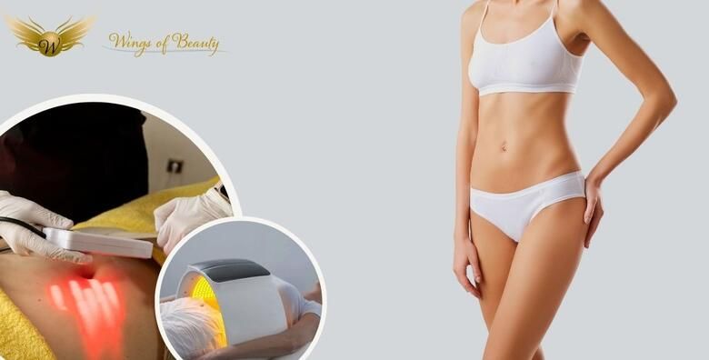 Oblikujte svoje tijelo uz 3 tretmana TERMODEKOM i 3 tretmana SLIMM KUPOLE u kozmetickom salonu Wings of Beauty
