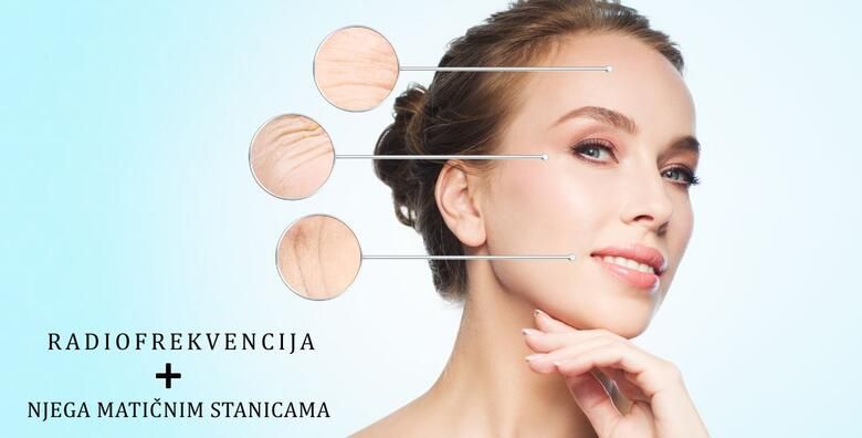 RADIOFREKVENCIJA  NJEGA MATICNIM STANICAMA  cvrsta i zategnuta koza lica u 90 minuta uz potpuno bezbolan tretman u Jean d`Arcel Medical  Beauty Institutu