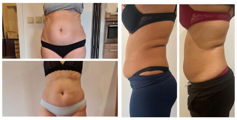 Mršavljenje - Akcija, popust i sniženje. (ponuda: 257123)