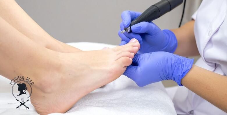 Zasluzena briga za vasa stopala  medicinska pedikura obrada jednog kurjeg oka i masaza stopla u trajanju 10 minuta u Salonu Kontesa Nera