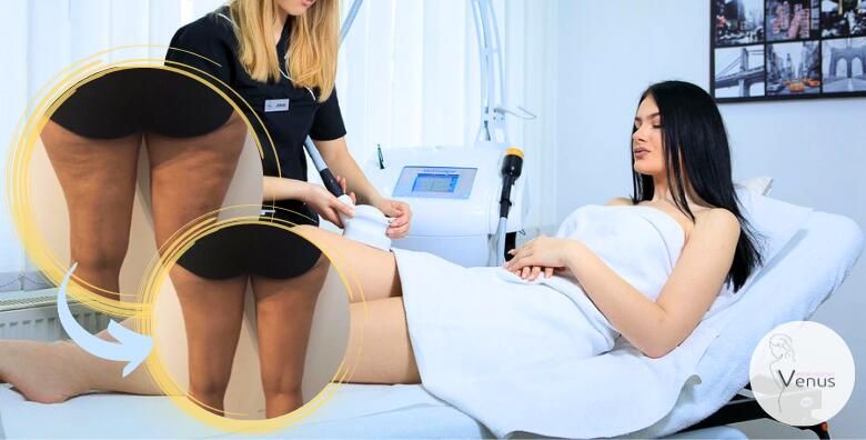 6x MED CONTOUR i 6x VIBROSAUNA SA DETOX TRETMANOM  DO 2 5 CM MANJE vec nakon prvog tretmana Isprobajte najbolji aparat na trzistu i budite u TOP formi do ljeta