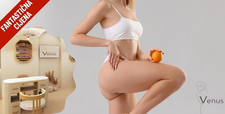 Ljepota (ponuda: 258825)