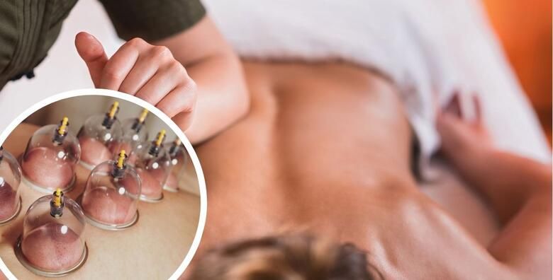 Sportsko medicinska masaza cijelog tijela s cupping terapijom u salonu Juran njega tijela