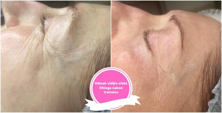 Ljepota (ponuda: 260241)