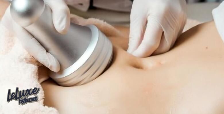 Ljepota (ponuda: 260375)