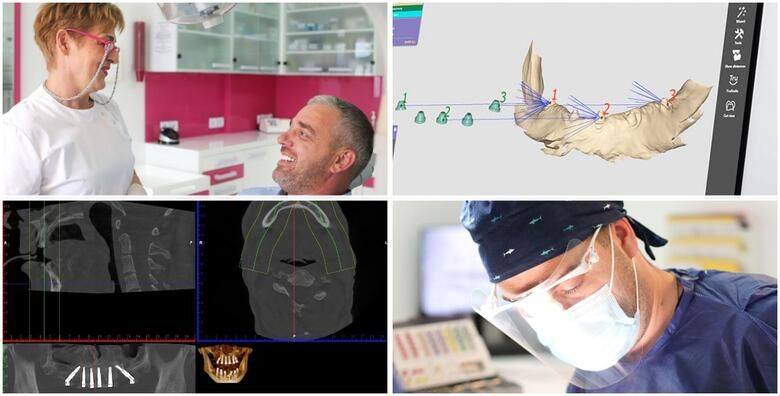 CBCT 3D snimka kompletne gornje i donje celjusti uz detaljnu analizu snimke besplatan dentalni pregled i konzultacije  uklonite sumnje na odredjene bolesti usne supljine