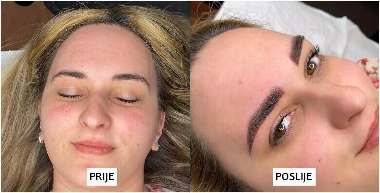 Estetska kirurgija - Akcija, popust i sniženje. (ponuda: 260737)