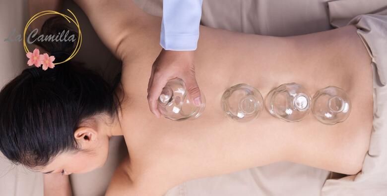 Iskusite moc medicinske masaze ledja i cupping terapije  prirodan put do olaksanja bola opustanja misica i bolje cirkulacije u La Cammila Beauty Baru