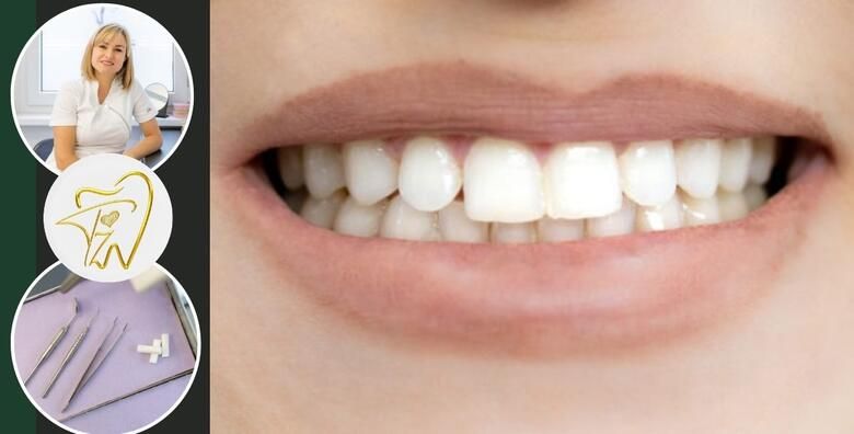 Ciscenje kamenca pjeskarenje i fluoridacija zubi u Ordinaciji dentalne medicine Tijana Zupan dr med dent 