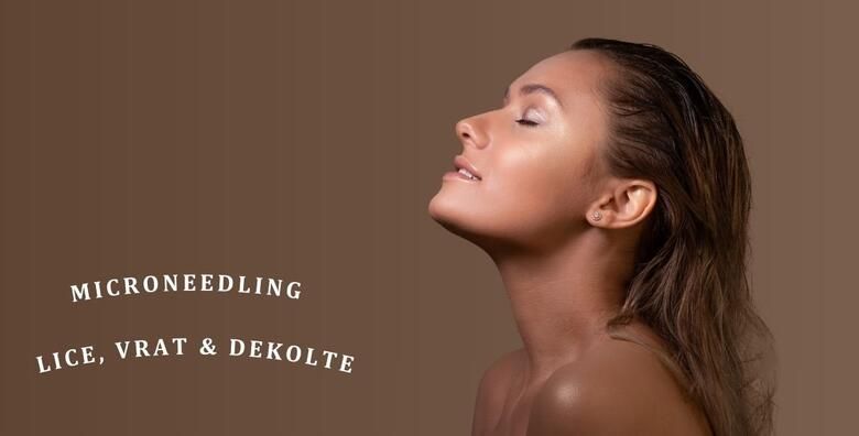 MICRONEEDLING LICA VRATA I DEKOLTEA  anti age tretman visokoucinkovite njege u Jean d`Arcel Medical  Beauty Institutu