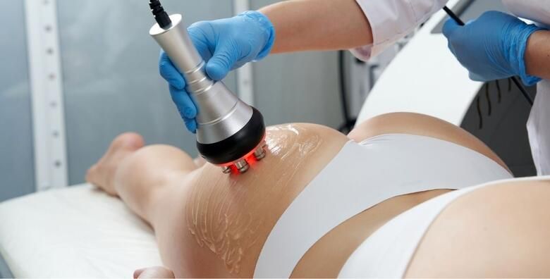 La Camilla Beauty Bar  kavitacija i tesla tretman za rjesavanje masnih naslaga