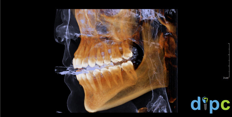 Ordinacija dentalne medicine Ivan Hurcak dr med dent