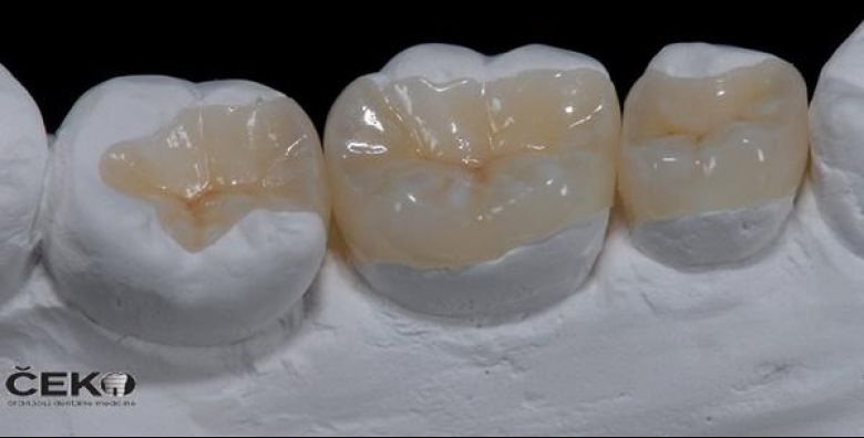 Ordinacija dentalne medicine Milorad Ceko dr med dent 