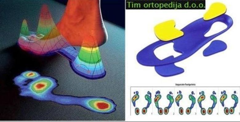 Tim ortopedija Tim ortopedija Tim ortopedija Tim ortopedija Tim ortopedija