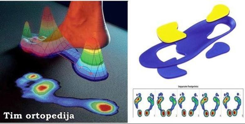 Tim ortopedija Tim ortopedija Tim ortopedija Tim ortopedija