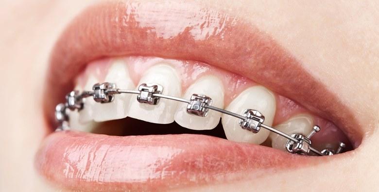 Privatna specijalisticka stomatoloska ordinacija za ortodonciju sa zubotehnickim labaratorijem mr sc Jadranka Kovacic dr stom spec ortodont